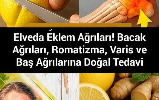 Elveda Eklem A’ğrıları! Bacak Ağrıları, Romatizma, Varis ve Baş A’ğrılarına D’oğal T’edavi