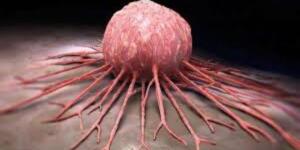 K-a’n ser Böyle Başlar ve Çok Az Kişi Bilir. İş’te O Belirtiler..