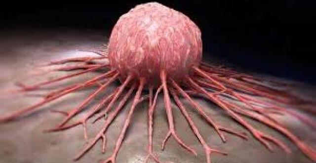 K-a’n ser Böyle Başlar ve Çok Az Kişi Bilir. İş’te O Belirtiler..